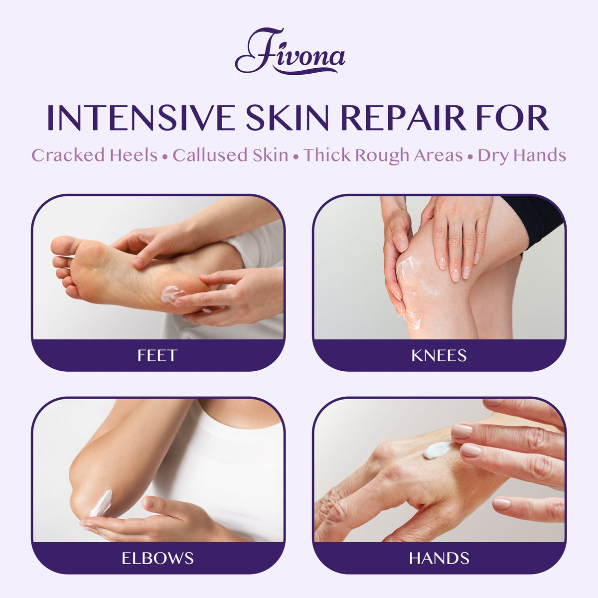40% Urea Cream with Lavender