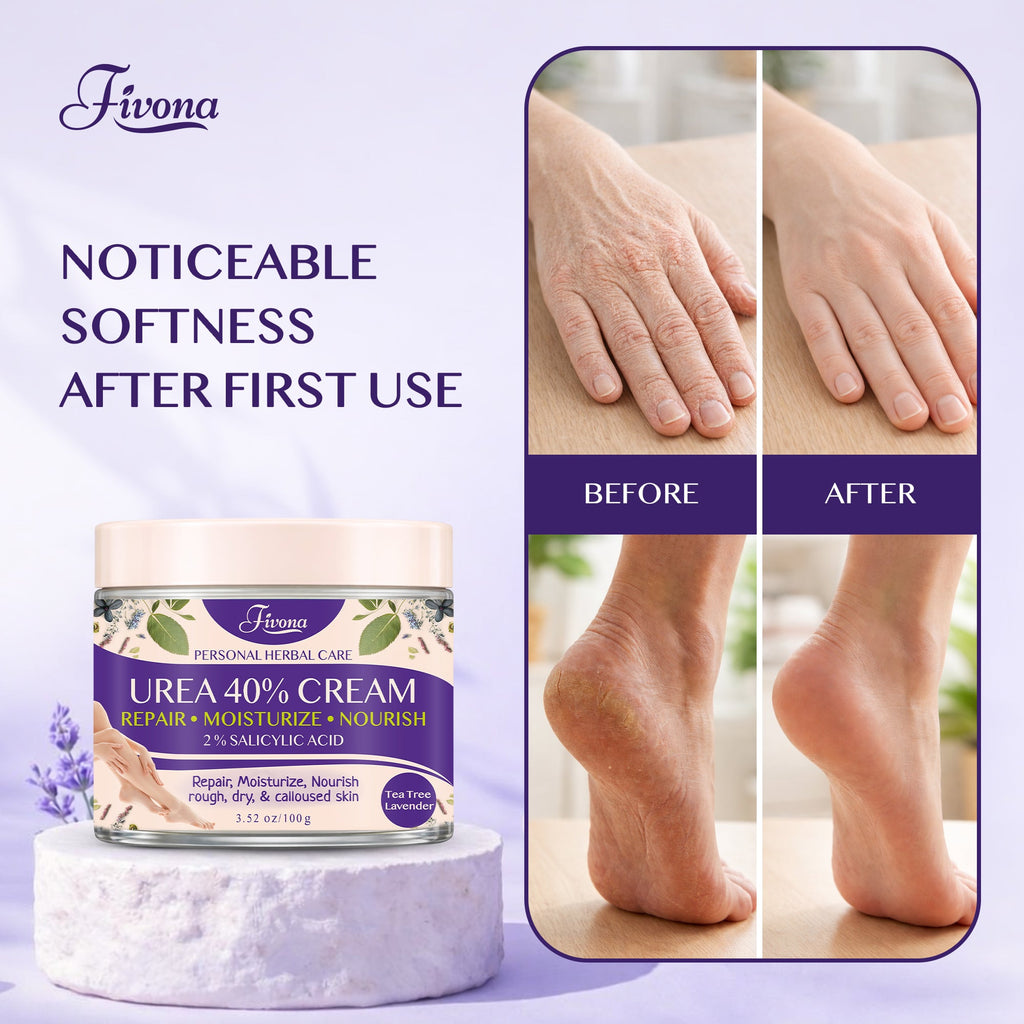 40% Urea Cream with Lavender