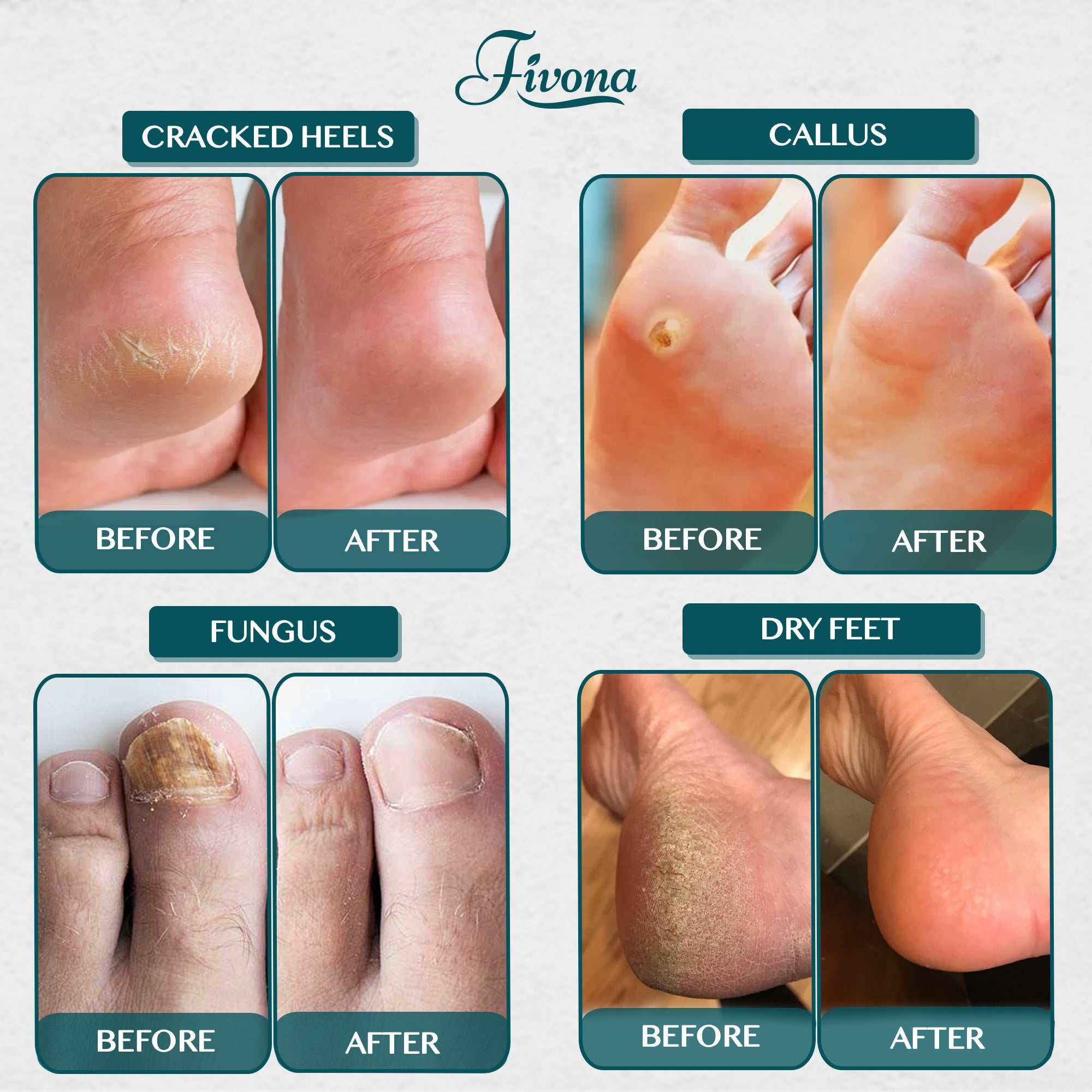 Foot Soak Blend with Tea Tree 14.1oz