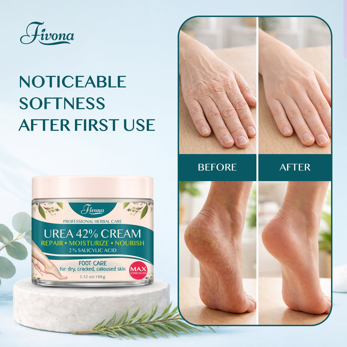 42% Urea Cream with Tea Tree – 100g (3.53 oz)